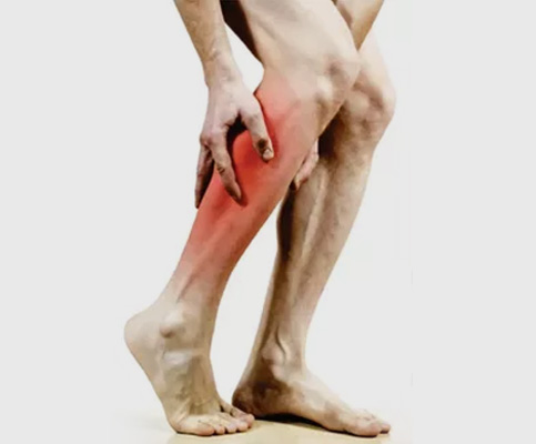 varicoseveins symptoms